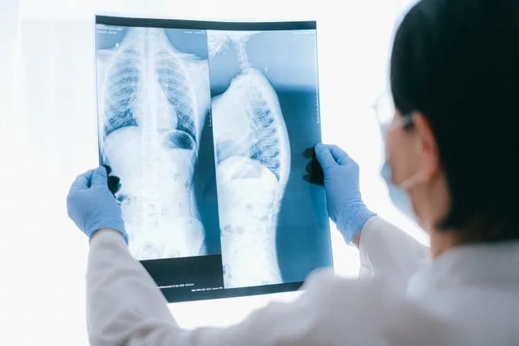 Jaki lekarz leczy osteoporozę: 5 najważniejszych specjalistów w terapii