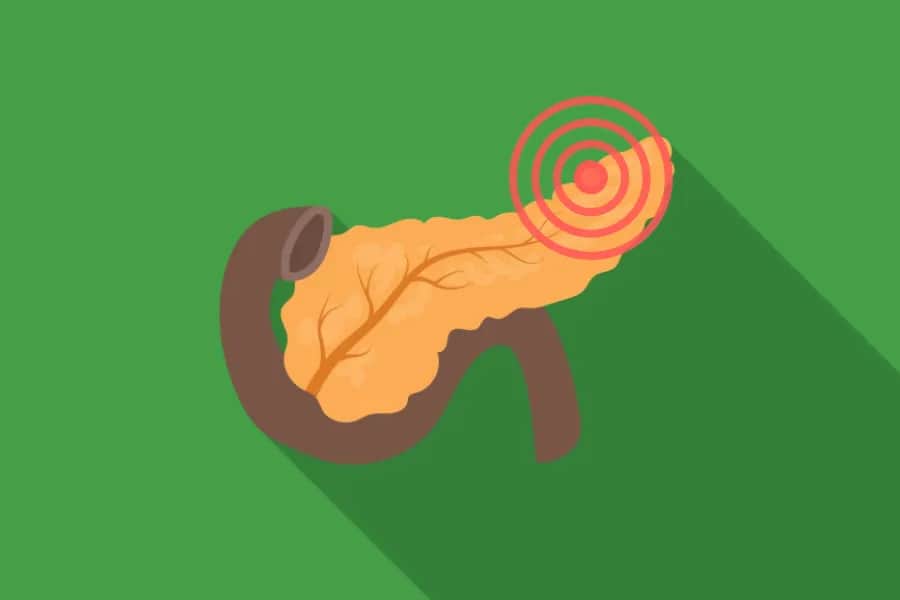 Niedobór enzymów trzustkowych objawy – jak je rozpoznać i leczyć