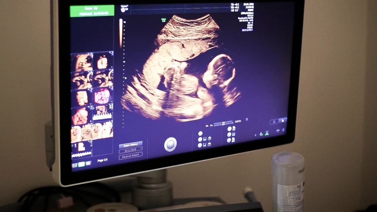 Jak się robi badania prenatalne? Poznaj metody i ich bezpieczeństwo Jak się robi badania prenatalne? Poznaj metody i ich bezpieczeństwo