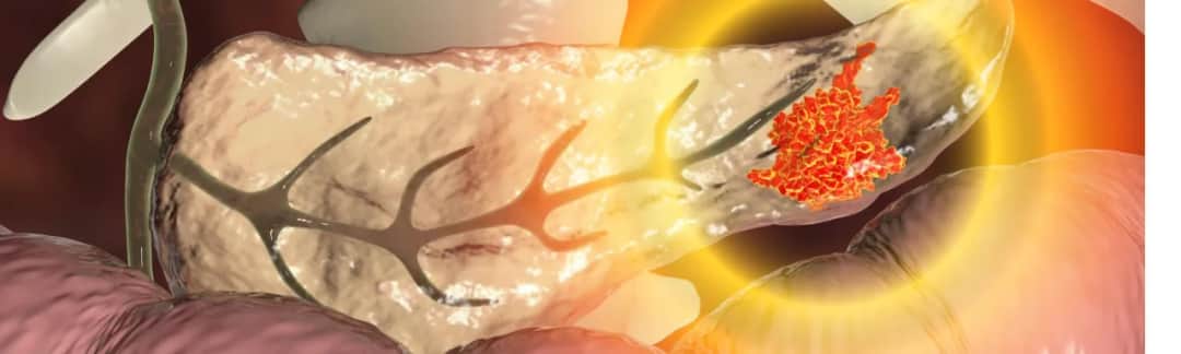 Kompletna lista badań na trzustkę: wszystko o diagnostyce i profilaktyce