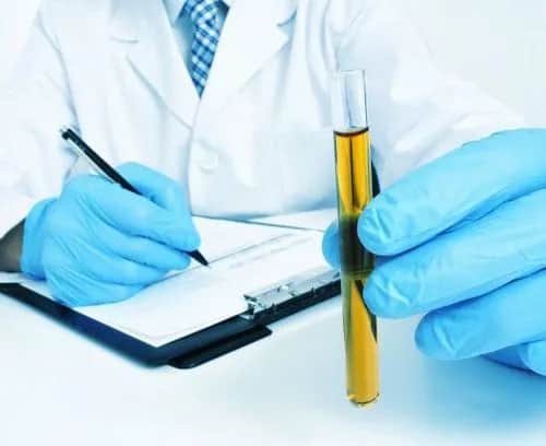 Co może wyjść z badania moczu i co oznaczają nieprawidłowości?