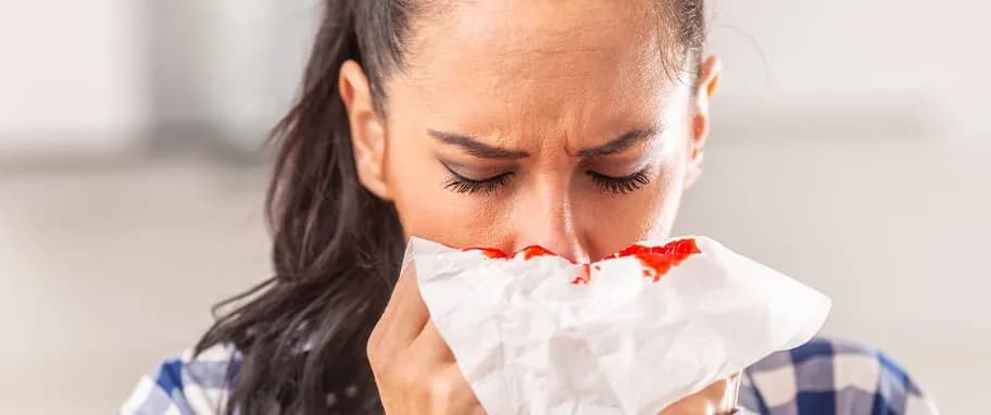 Krew z nosa przyczyny: poznaj najczęstsze powody i objawy