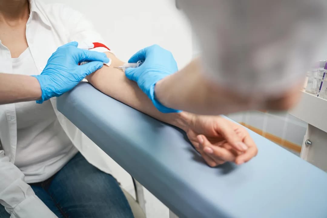 MCHC w badaniu krwi - co to oznacza dla Twojego zdrowia i samopoczucia