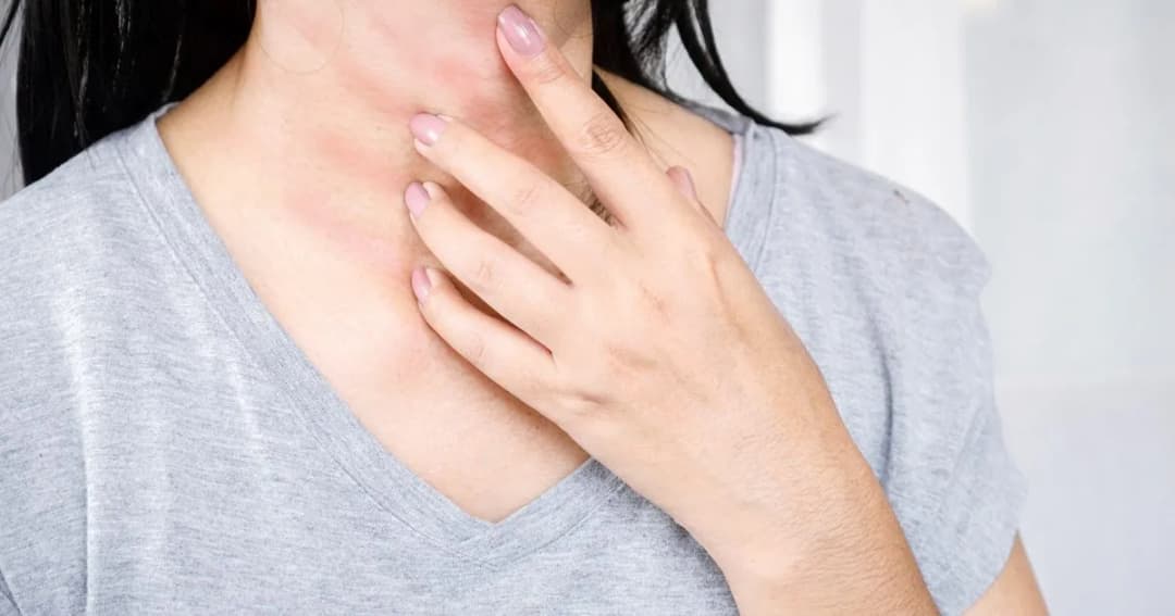 Czy piwo może uczulać? Objawy i unikanie reakcji alergicznych