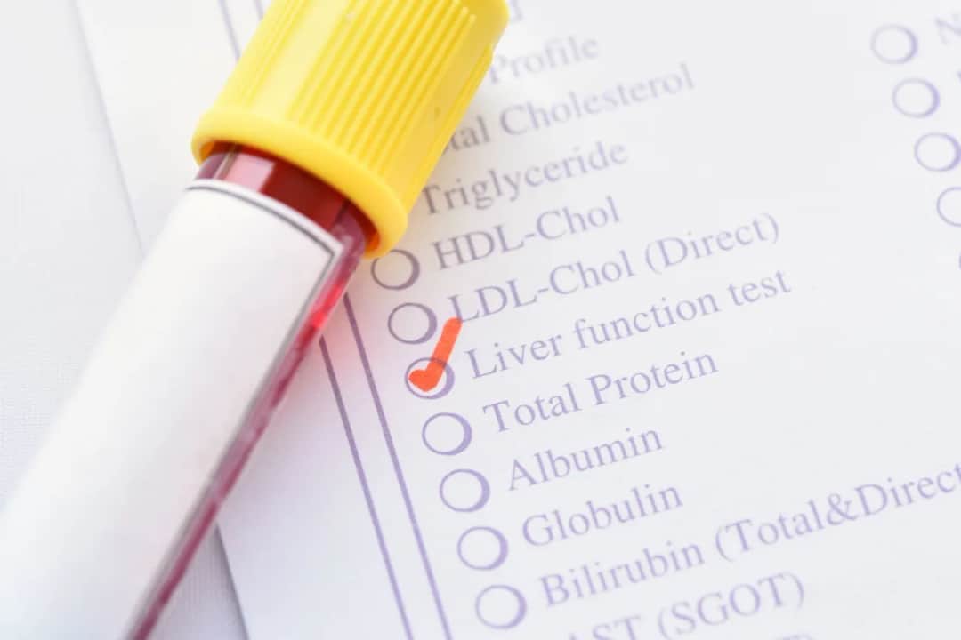 Transaminazy – co to za badanie i jakie mają znaczenie dla zdrowia?