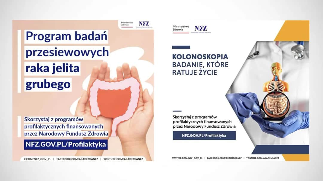 Kolonoskopia NFZ bez długiego czekania - zobacz najszybsze terminy 2025