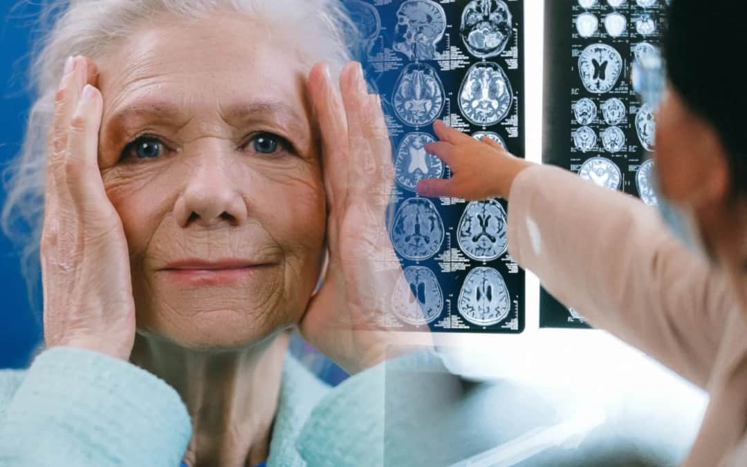 Cichy udar – objawy, które łatwo przeoczyć i ich poważne konsekwencje