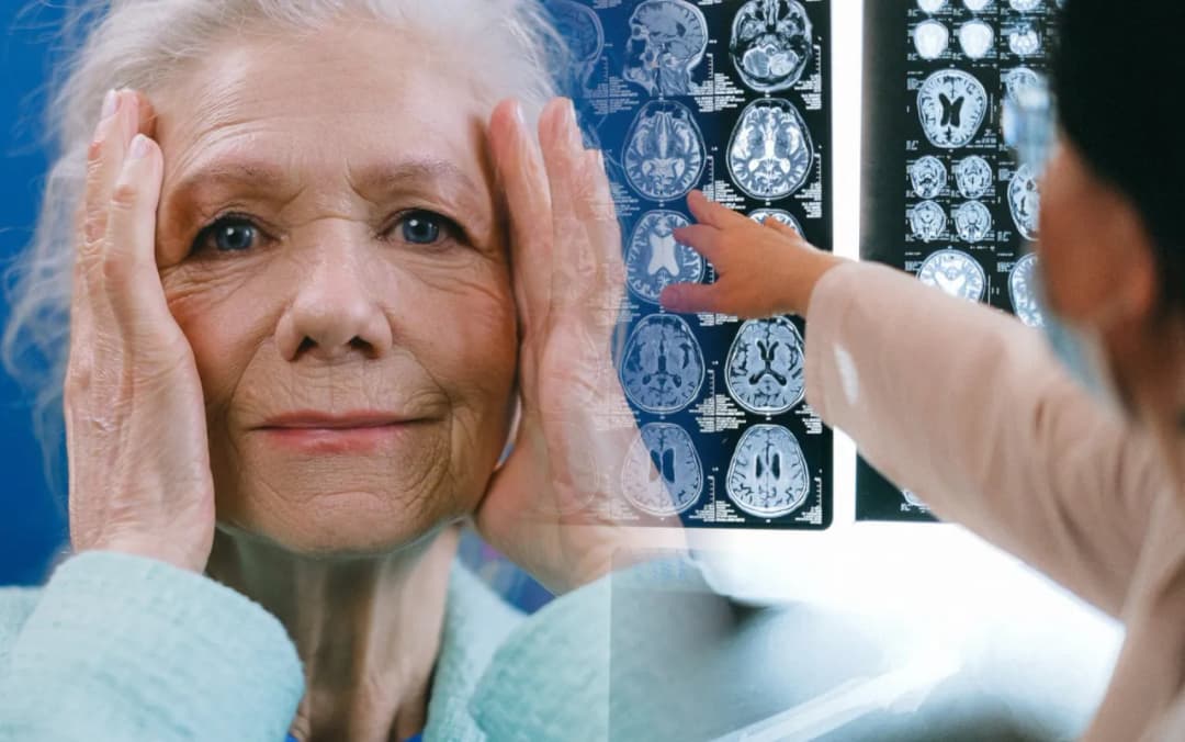 Cichy udar – objawy, które łatwo przeoczyć i ich poważne konsekwencje