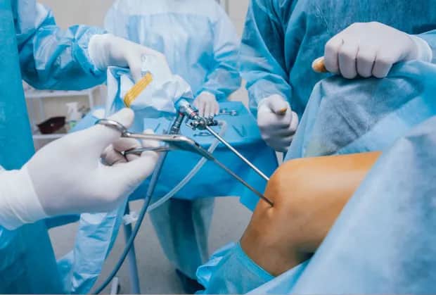 Artroskopia kolana NFZ gdzie najszybciej: Lista wolnych terminów 2025