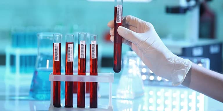 Czy w morfologii wyjdzie alkohol? Co musisz wiedzieć o wynikach