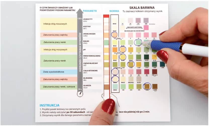 Co wykryje badanie moczu? Wszystko co musisz wiedzieć o analizie