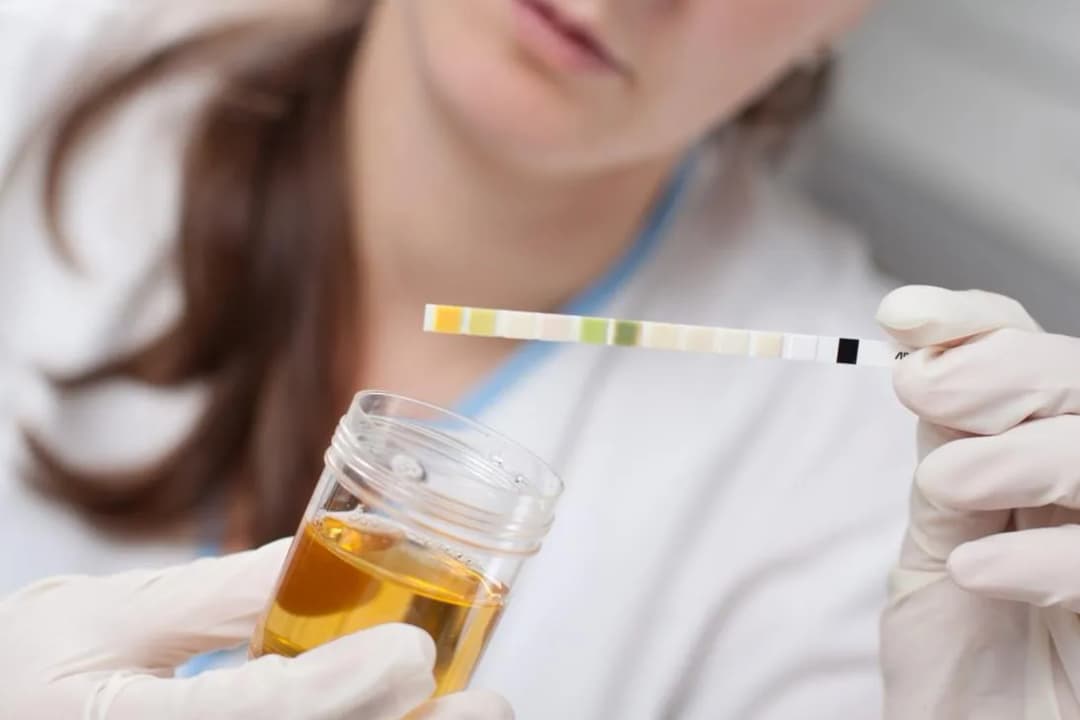 Co wykryje badanie moczu? Choroby, infekcje i niepokojące wyniki wyjaśnione