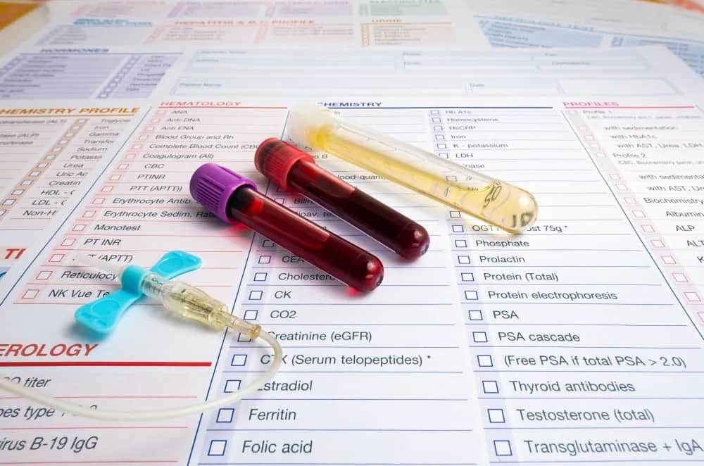 Jakie badanie krwi wykryje raka: poznaj najważniejsze markery nowotworowe