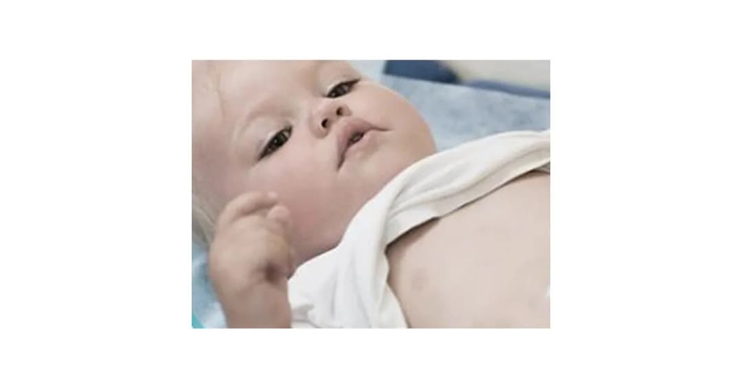 Kiedy mijają bóle brzuszka u niemowląt? Poznaj przyczyny i rozwiązania