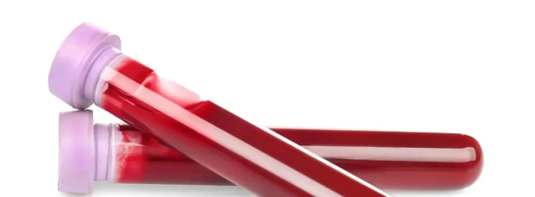 Ile kosztuje badanie grupy krwi w Polsce? Ceny, które warto znać