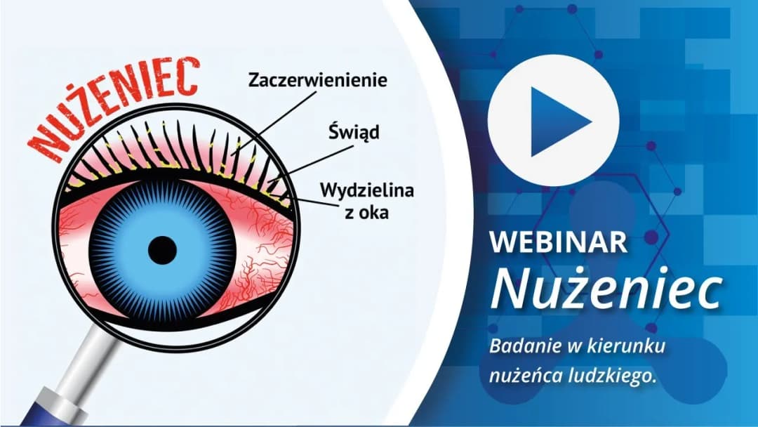 Gdzie zrobić badanie na nużeńca? Sprawdź, gdzie uzyskać wyniki szybko