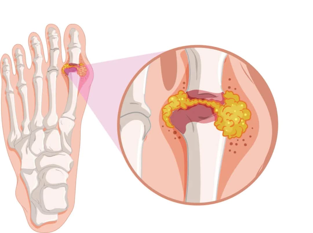 Dna moczanowa jaki lekarz najlepiej pomoże - poznaj wszystkich specjalistów