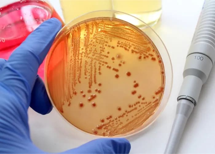 Wysokie CRP przyczyny: Co może wskazywać na poważne problemy zdrowotne?