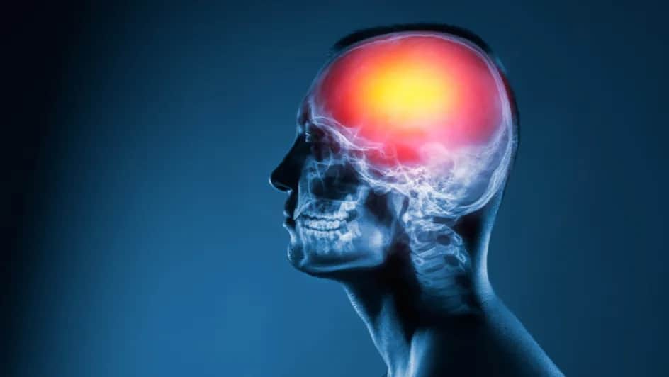 Czy po udarze mózgu można wrócić do pracy? Kluczowe czynniki i porady