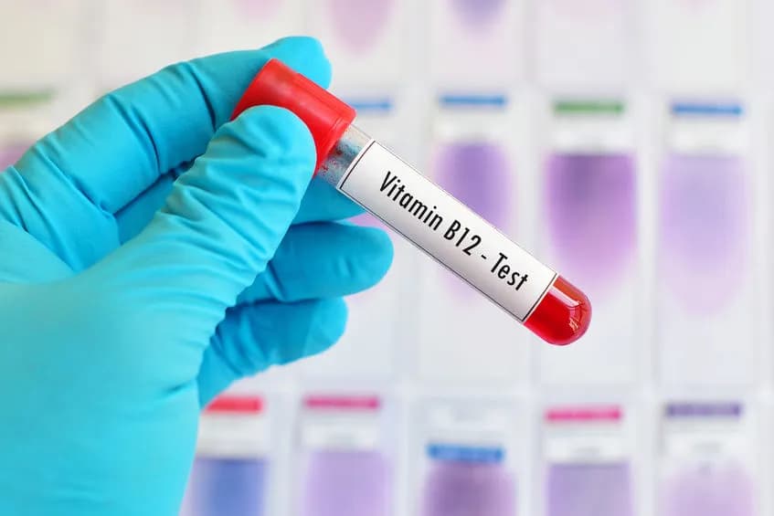 Ile kosztuje badanie witaminy B12 w Polsce? Ceny i ważne informacje