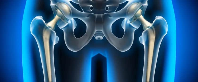 Bóle biodra przyczyny: odkryj, co może powodować Twój dyskomfort