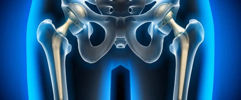 Bóle biodra przyczyny: odkryj, co może powodować Twój dyskomfort