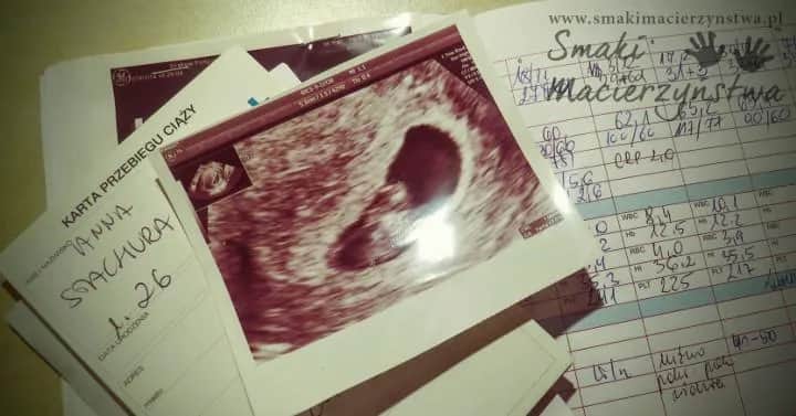 Jakie badania na początku ciąży są kluczowe dla zdrowia matki i dziecka?