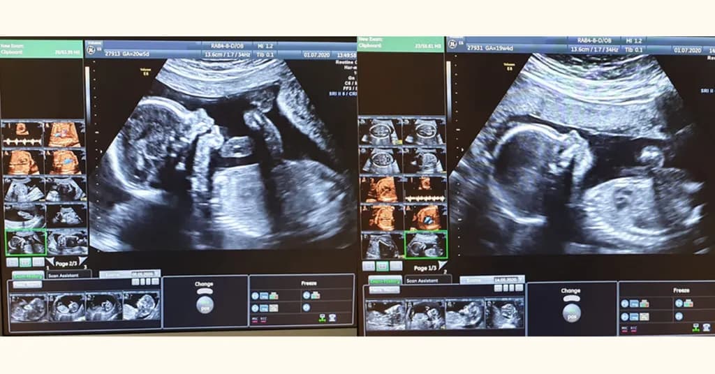 Jak wyglądają badania prenatalne i co warto o nich wiedzieć?
