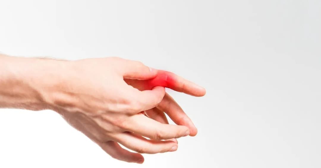 Przyczyny dny moczanowej: co wywołuje ból i podagrę?