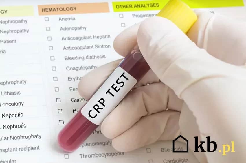 Ile kosztuje badanie CRP i co warto wiedzieć przed jego wykonaniem